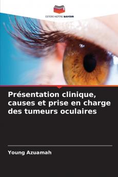 Présentation clinique causes et prise en charge des tumeurs oculaires