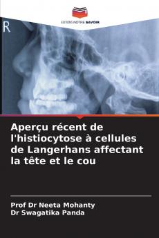 Aperçu récent de l'histiocytose à cellules de Langerhans affectant la tête et le cou