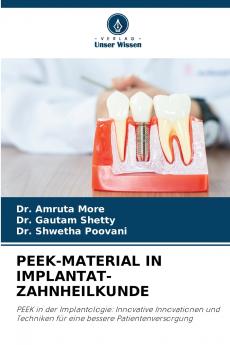 PEEK-MATERIAL IN IMPLANTAT-ZAHNHEILKUNDE