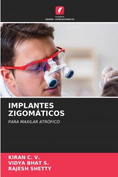 IMPLANTES ZIGOMÁTICOS