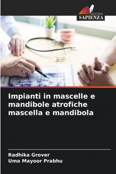 Impianti in mascelle e mandibole atrofiche mascella e mandibola