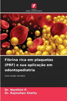 Fibrina rica em plaquetas (PRF) e sua aplicação em odontopediatria