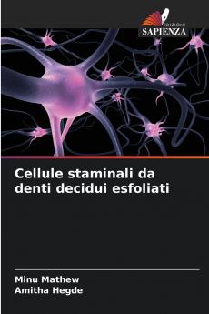 Cellule staminali da denti decidui esfoliati