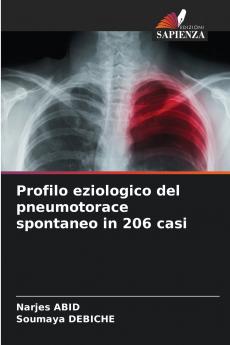 Profilo eziologico del pneumotorace spontaneo in 206 casi