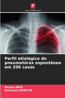 Perfil etiológico do pneumotórax espontâneo em 206 casos