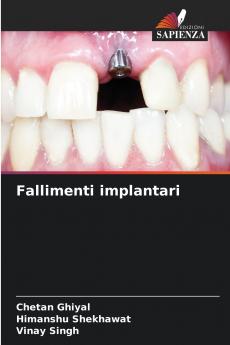 Fallimenti implantari