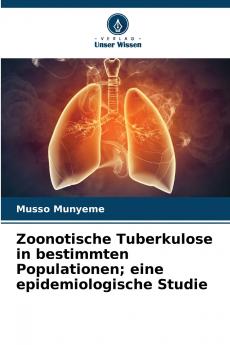 Zoonotische Tuberkulose in bestimmten Populationen; eine epidemiologische Studie