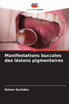 Manifestations buccales des lésions pigmentaires