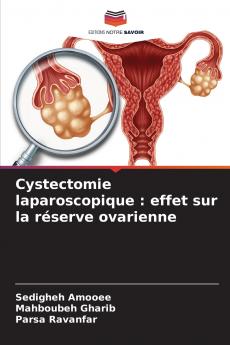 Cystectomie laparoscopique