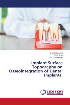 Implant Surface Topography on Osseointegration of Dental Implants