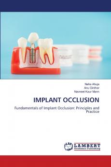 IMPLANT OCCLUSION