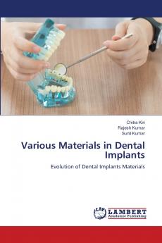 Various Materials in Dental Implants