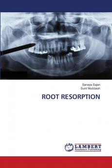 ROOT RESORPTION