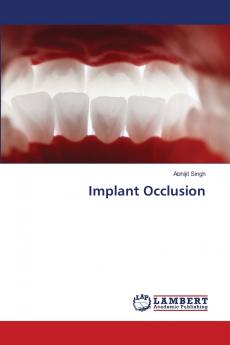 Implant Occlusion