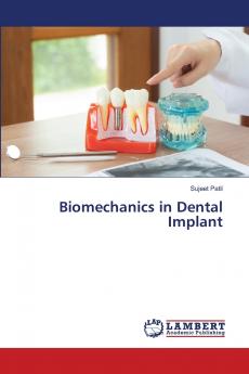 Biomechanics in Dental Implant