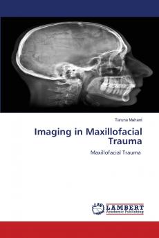 Imaging in Maxillofacial Trauma
