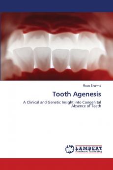 Tooth Agenesis