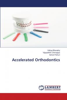 Accelerated Orthodontics