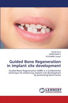 Guided Bone Regeneration in implant site development