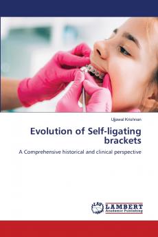Evolution of Self-ligating brackets