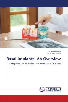 Basal Implants