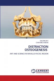 DISTRACTION OSTEOGENESIS