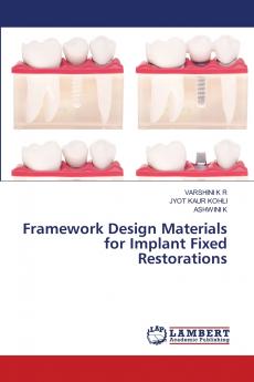 Framework Design Materials for Implant Fixed Restorations