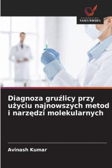 Diagnoza gruźlicy przy użyciu najnowszych metod i narzędzi molekularnych