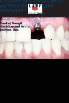 GESTION DES TISSUS MOUS AUTOUR DE L'IMPLANT DENTAIRE