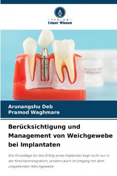 Berücksichtigung und Management von Weichgewebe bei Implantaten
