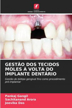 GESTÃO DOS TECIDOS MOLES À VOLTA DO IMPLANTE DENTÁRIO