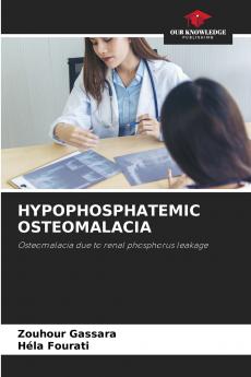 HYPOPHOSPHATEMIC OSTEOMALACIA