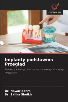 Implanty podstawne