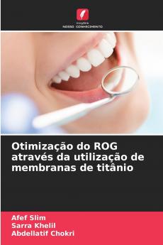 Otimização do ROG através da utilização de membranas de titânio