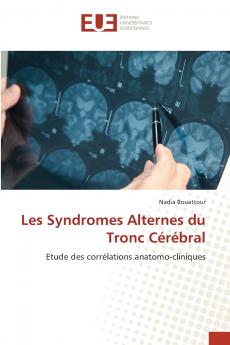 Les Syndromes Alternes du Tronc Cérébral