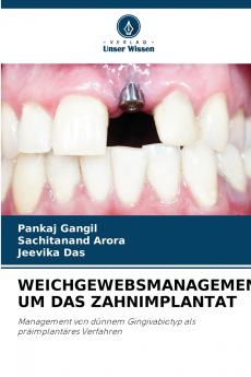 WEICHGEWEBSMANAGEMENT UM DAS ZAHNIMPLANTAT