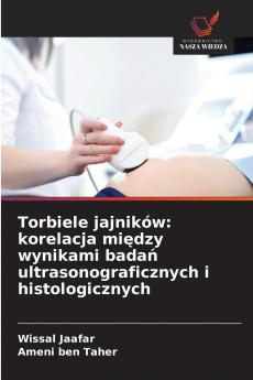 Torbiele jajników