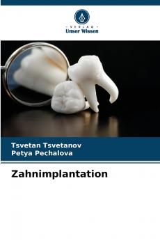 Zahnimplantation