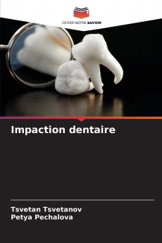 Impaction dentaire