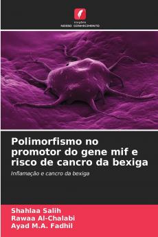Polimorfismo no promotor do gene mif e risco de cancro da bexiga