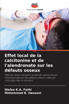 Effet local de la calcitonine et de l'alendronate sur les défauts osseux