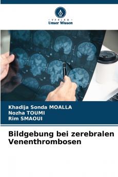Bildgebung bei zerebralen Venenthrombosen