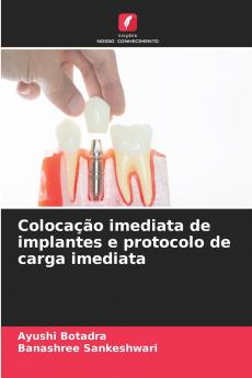 Colocação imediata de implantes e protocolo de carga imediata
