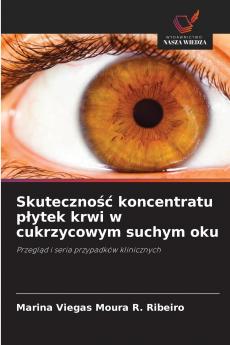 Skuteczno?? koncentratu p?ytek krwi w cukrzycowym suchym oku