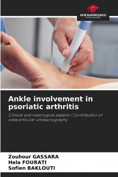 Ankle involvement in psoriatic arthritis