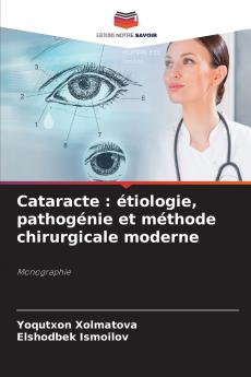Cataracte