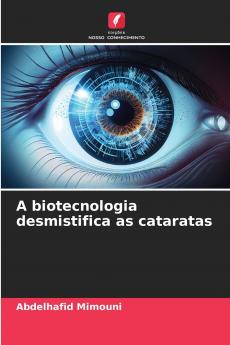 A biotecnologia desmistifica as cataratas