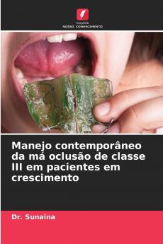 Manejo contemporâneo da má oclusão de classe III em pacientes em crescimento