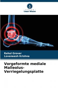 Vorgeformte mediale Malleolus-Verriegelungsplatte
