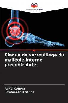 Plaque de verrouillage du malléole interne précontrainte